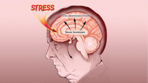 How to Manage Your Stress Hormones